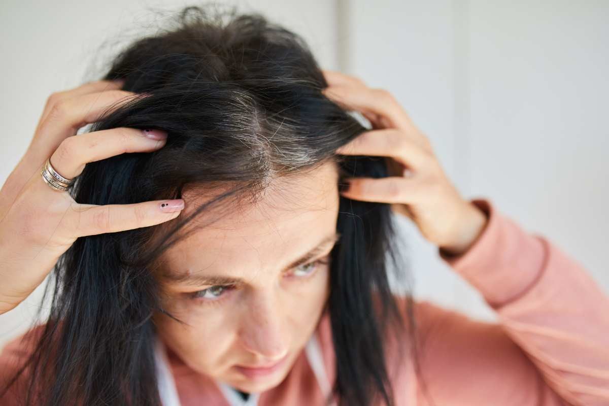 Addio ai capelli bianchi, con questo trucco non ti servono le classiche tinte: elimini la ricrescita gratis
